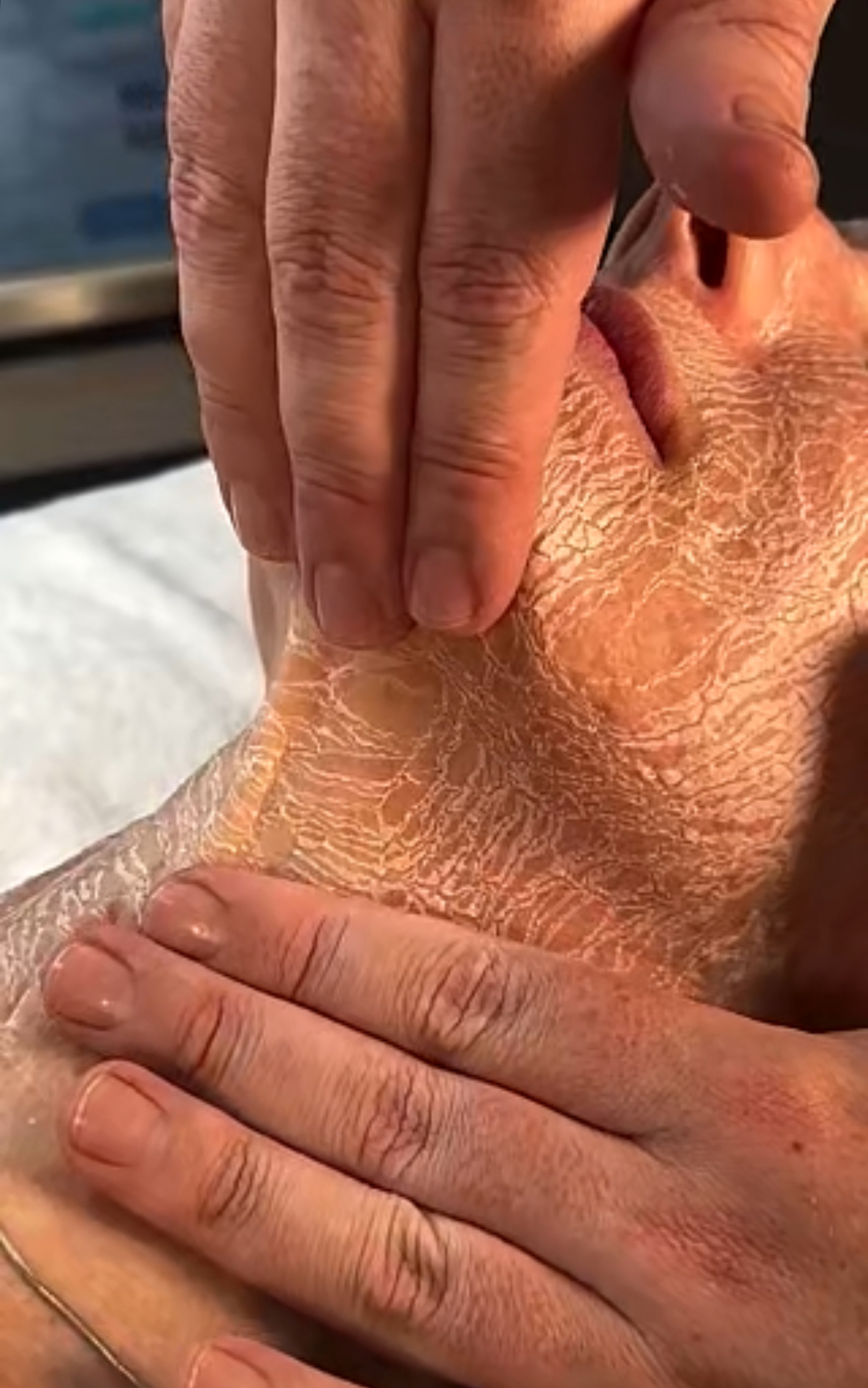 What Happens to Your Skin During This Unique Treatment?