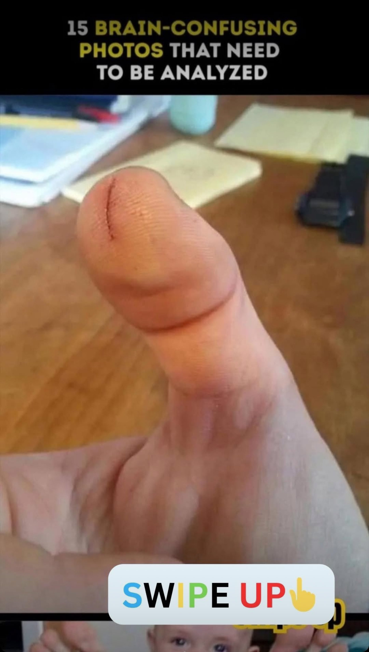 The Ultimate Optical Illusion: Finger or Toe?